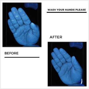 Why 20 seconds of washing your hands is so important. See before & after.